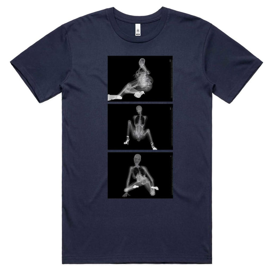 X-ray Skull T-shirt